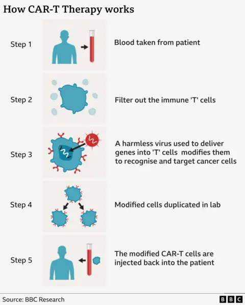 A graphic labelled: How Car-T Therapy works. It shows five illustrated steps of the treatment starting with an blood vial then several images of blue cells.