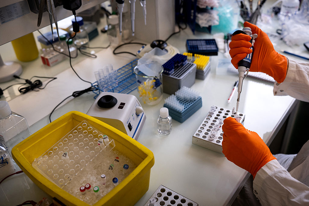 A laboratory technician prepares enzymes used to make individualised cancer vaccine