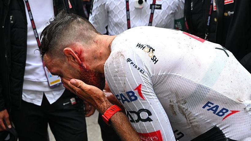 Adam Yates assess his injuries following a crash during stage 2 of the Giro d'Italia