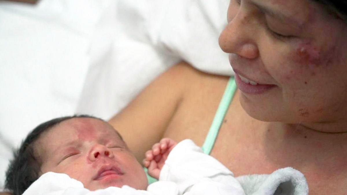 Dayana Patino looks down at her son Juan David smiling from a hospital bed Caracas. Both mother and baby have injuries on their faces