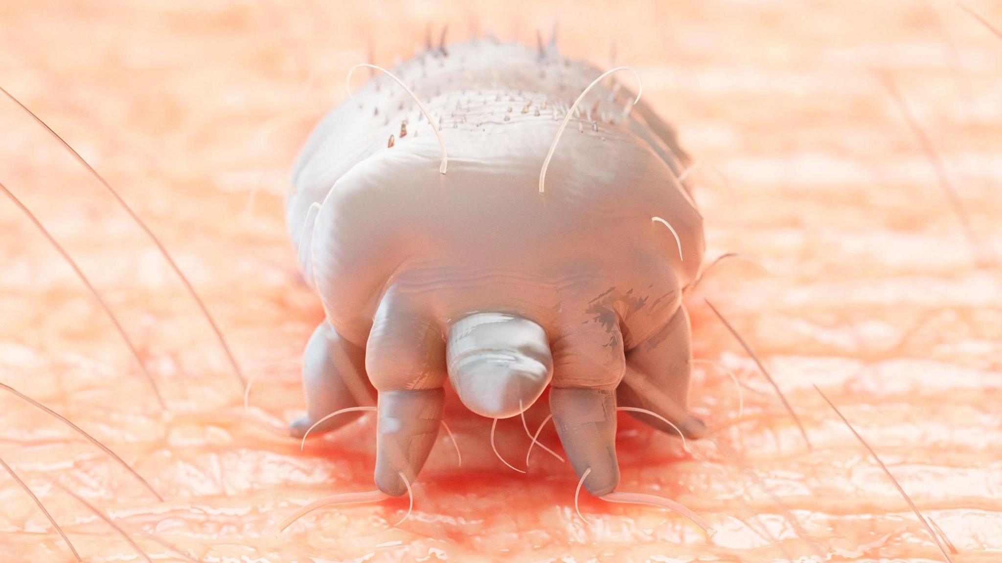 An artist impression of a mite on the skin.