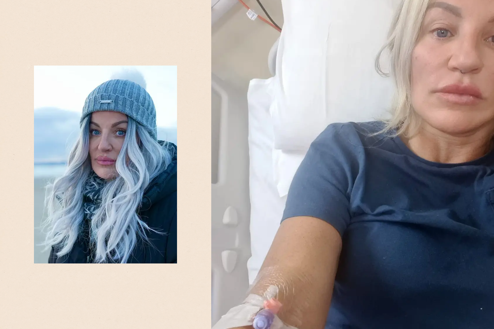 A montage image showing two photographs of Joanne. On the left, she has fashionably dyed grey hair and blue eyes, wears a grey woolly hat and black coat, and looks seriously at the camera on an empty Welsh beach at dusk. On the right is a selfie of Joanne in hospital, with a canula in her arm. She is wearing a navy blue T-shirt and has blonde hair. The white sheets of the hospital bed can be seen in part of the frame.