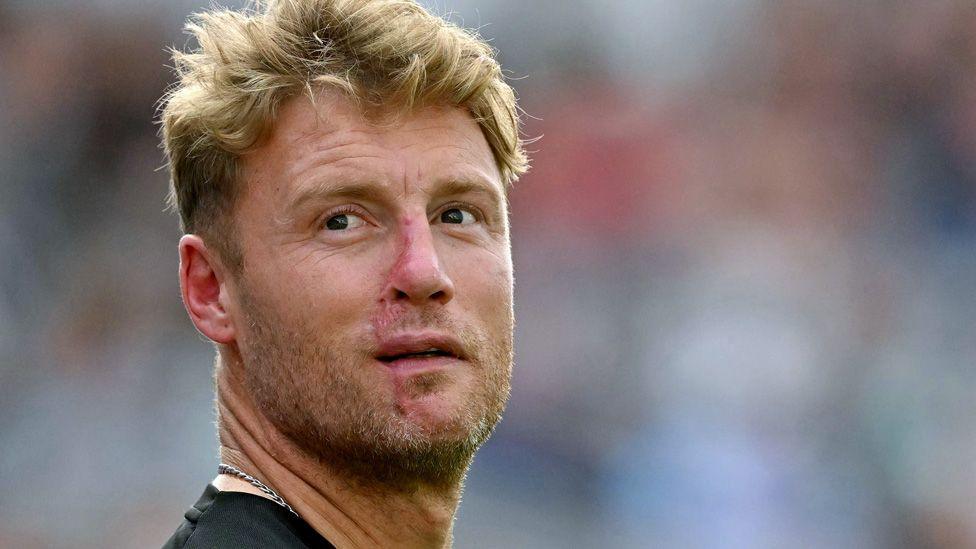 Andrew Flintoff with a visible scar down his nose and mouth