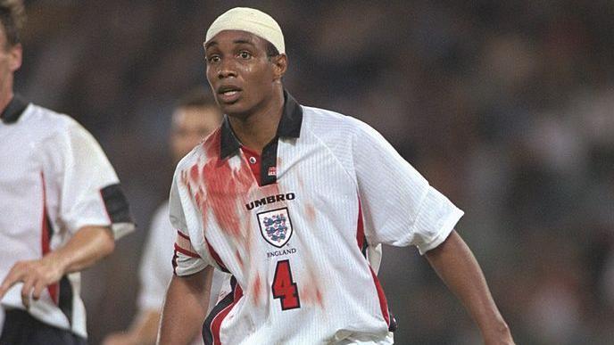 Paul Ince with a bloodied shirt and head bandage