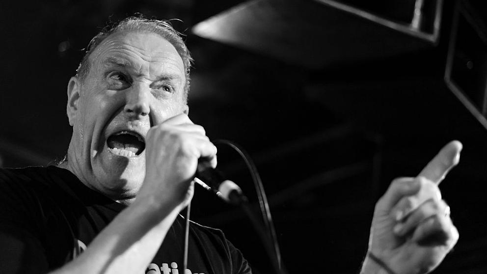 Black and white image of Richard Jobson from The Skids whose mouth is wide open as he sings into a mic and points his finger
