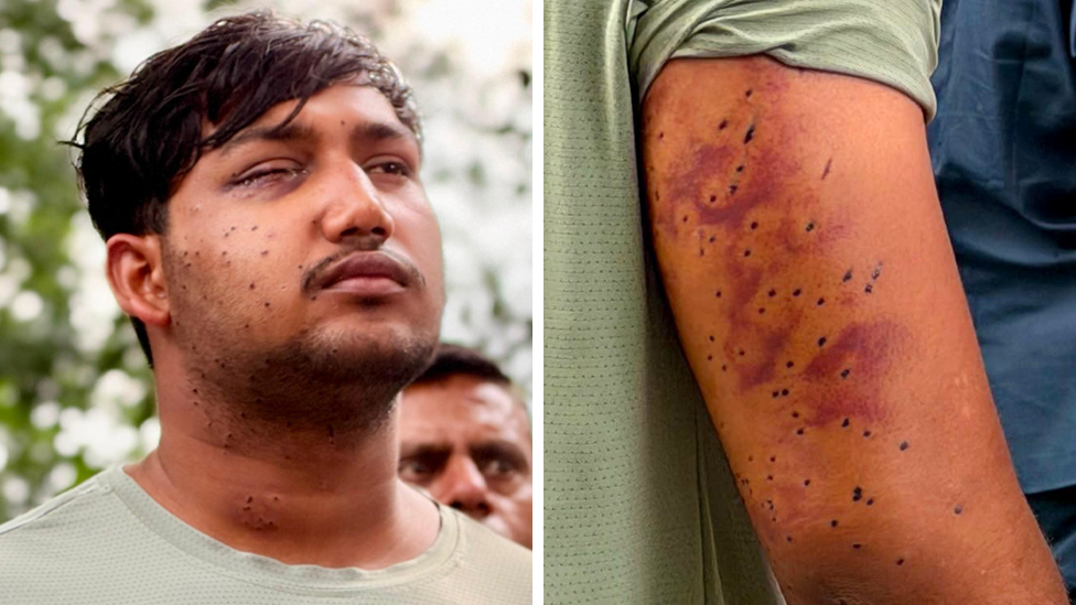 India’s ‘cockroach’ protesters have wounds consistent with pellet-gun fire, say experts India’s ‘cockroach’ protesters have wounds consistent with pellet-gun fire, say experts