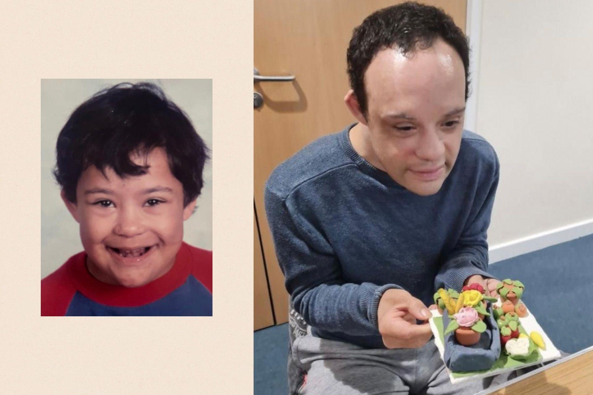 Left: Daniel Lindsay when he was younger. Right: Daniel Lindsay at his care home.