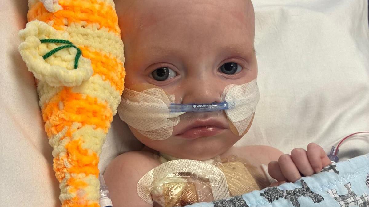 Macs Green is a small baby. He is lying in a hospital bed with a tube coming from his nose. He has an orange cuddly toy on his right
