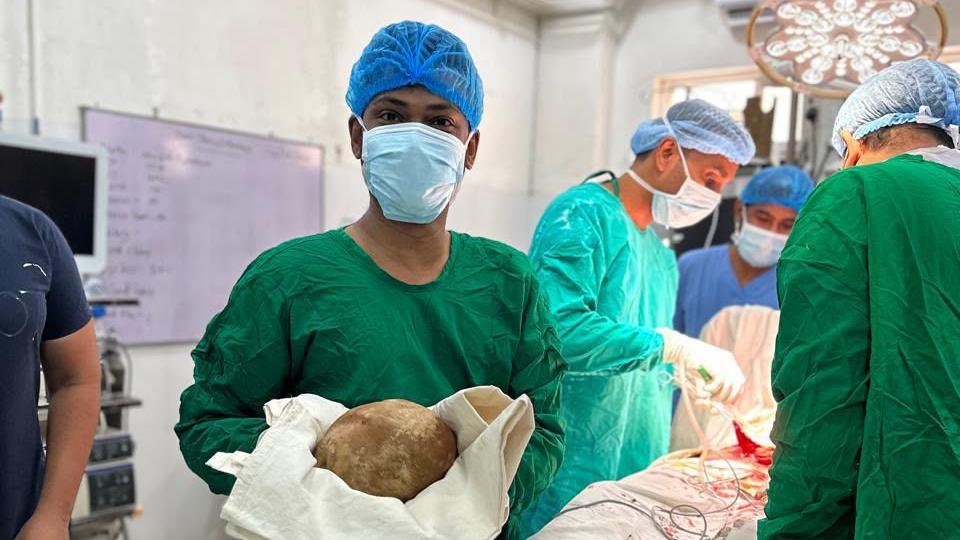Doctors remove 3.1kg stone from man’s bladder and claim record Doctors remove 3.1kg stone from man’s bladder and claim record
