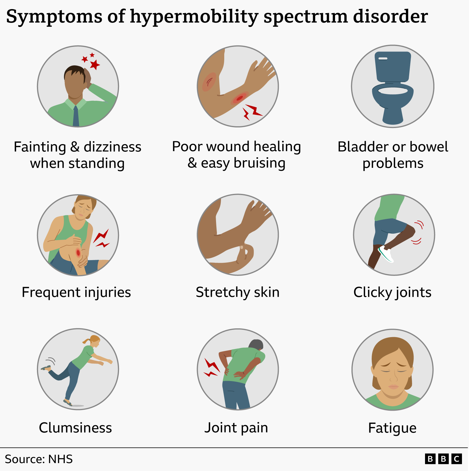Graphic listing symptoms of joint hypermobility: fainting or dizziness when standing, poor wound healing and easy bruising, bladder or bowel problems, frequent injuries, stretchy skin, clicky joints, clumsiness, joint pain, and fatigue