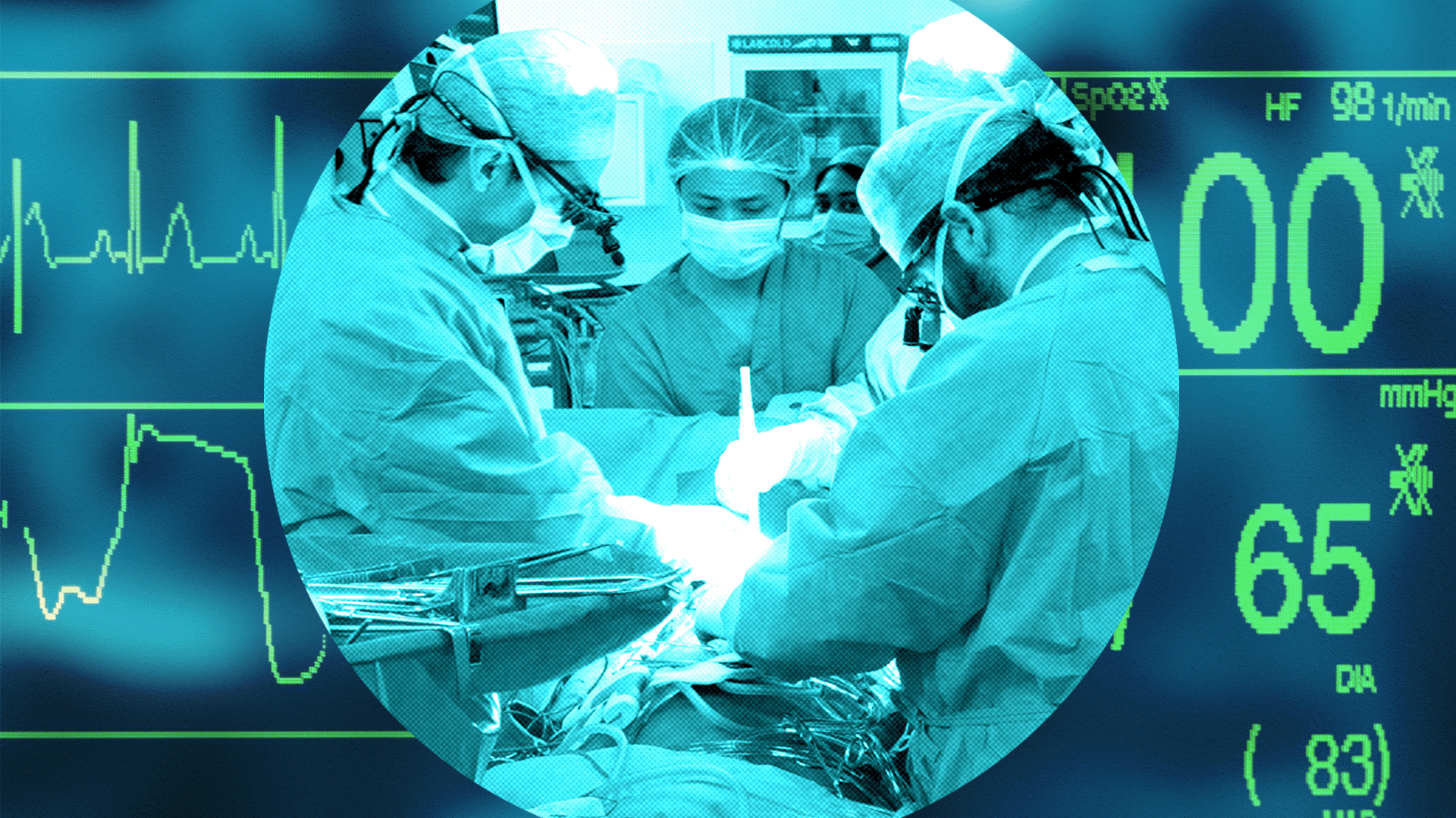 A surgical team in an operating room performs a procedure on a patient. The team is wearing surgical gowns, gloves, and head coverings, working around an operating table with medical instruments. The scene is overlaid with large digital displays of vital signs, including heart rate, blood pressure, and waveform readings.