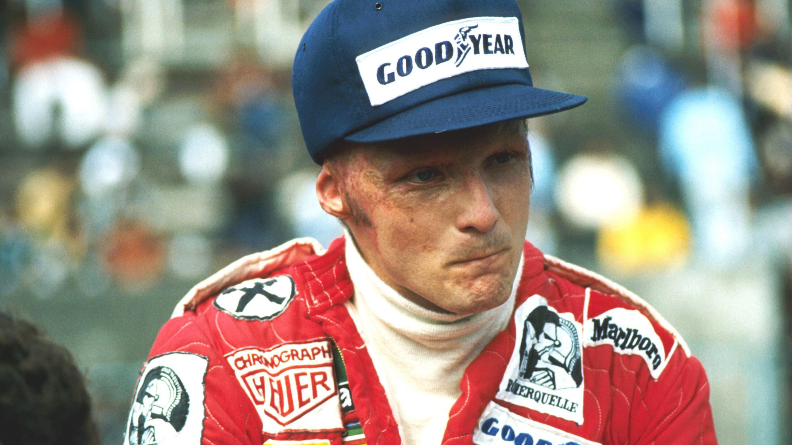 Niki Lauda in his Ferrari uniform at the 1976 Italian Grand Prix. Scarring from burns he suffered six weeks earlier in a near-fatal accident in Germany is clearly visible