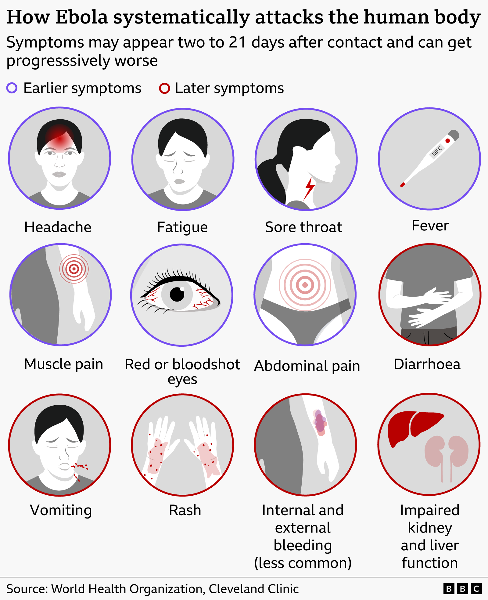 Graphic showing how in stages Ebola attacks the human body