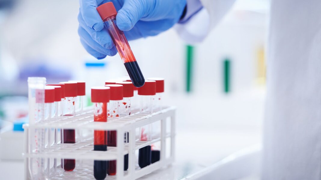 England ‘on the cusp’ of eliminating virus that causes serious harm England ‘on the cusp’ of eliminating virus that causes serious harm