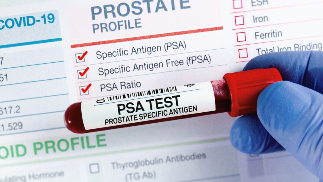 Prostate cancer cases surge in UK – as charity warns against ‘myths’ Prostate cancer cases surge in UK – as charity warns against ‘myths’