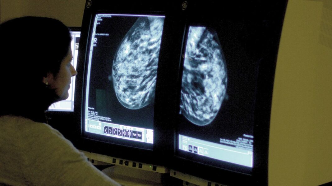 Women under 50 at risk of breast cancer are not being referred – study Women under 50 at risk of breast cancer are not being referred – study