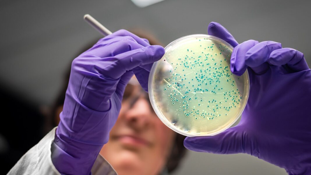 One dead and hundreds ill in UK salmonella outbreak One dead and hundreds ill in UK salmonella outbreak