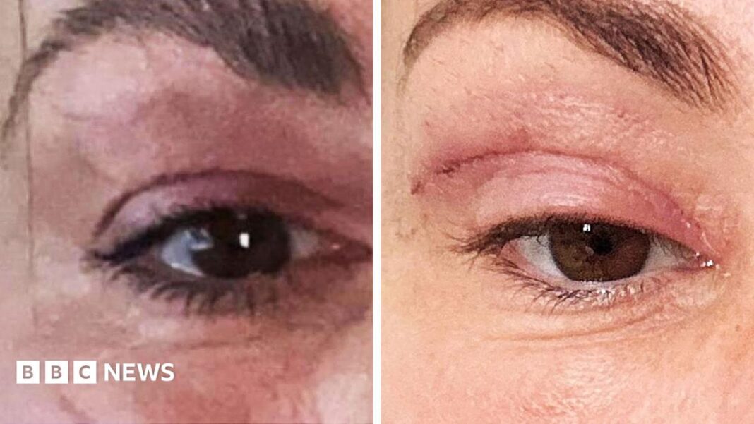 ‘My eyelids became infected – I was scared to sleep’ image