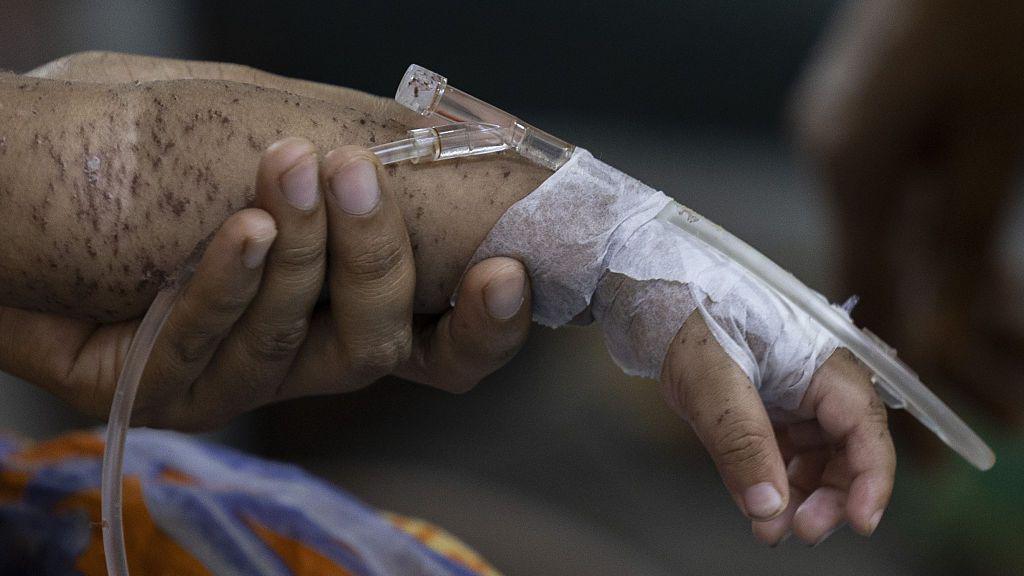 A child's arm covered in blisters, with tape around its hand and a cannula, held up by an adult's hand