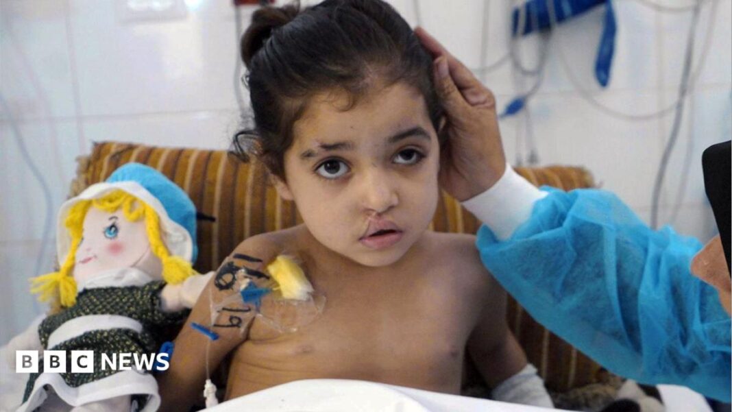 Girl has multiple surgeries to control infections after strike in Gaza image