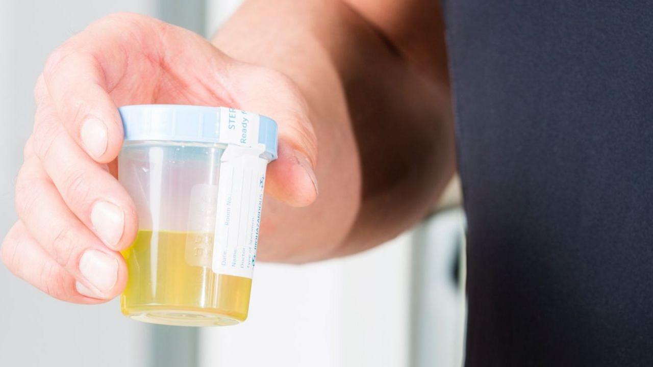 A man holds a urine sample in a pot