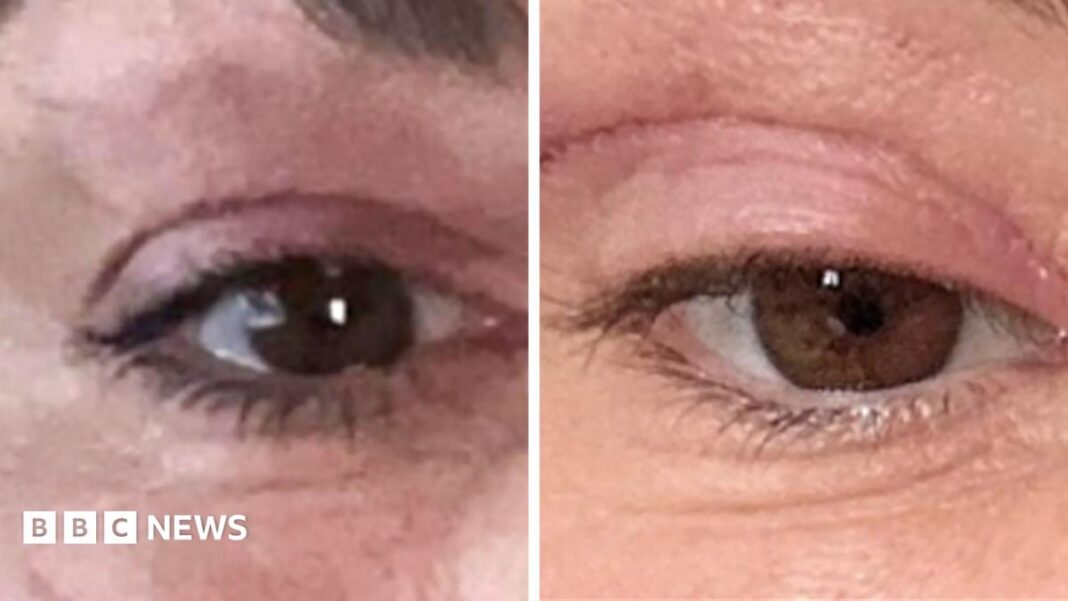 ‘My eyelids became infected – I was scared to sleep’ image