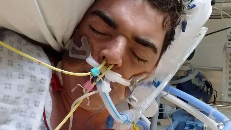 Oliver pictured in hospital in 2016. He is lying in bed with tubes coming out of his nose and mouth for water and ventilation. The family gave the BBC permission to use this photograph.