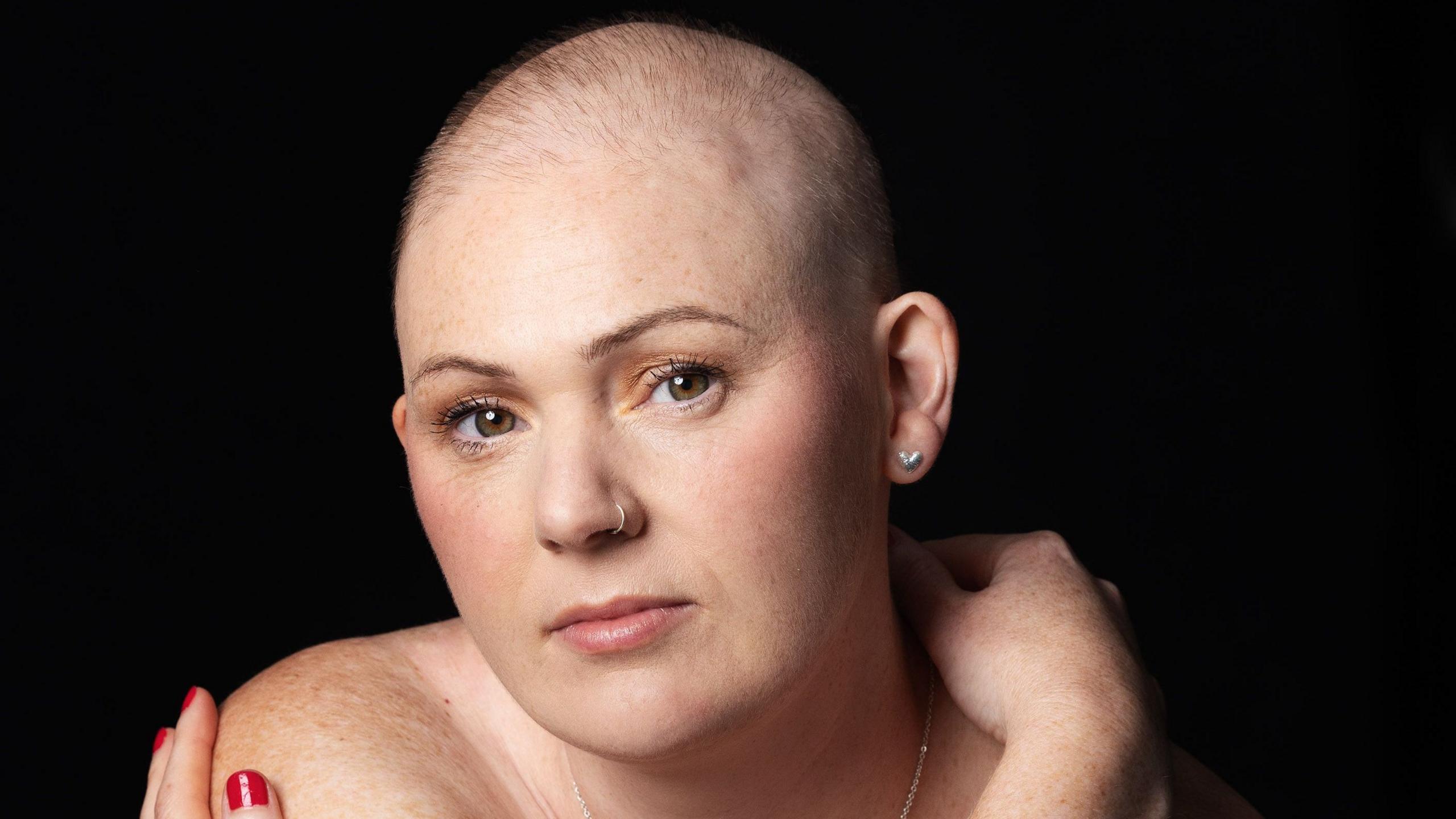 Rhiannon looking into the camera with a thoughtful expression on her face. She is almost completely bald. She has a silver hoop nose ring and silver heart stud earrings.