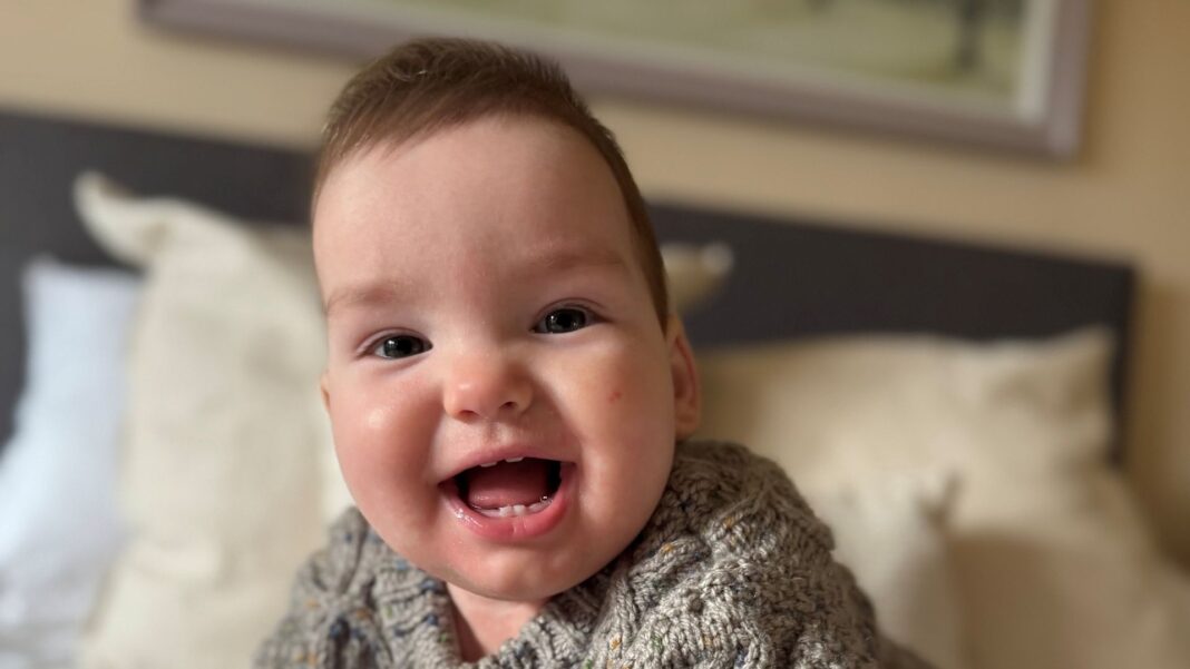 Baby boy given world-first treatment for rare skull condition Skynews rory potter skull condition 7344694