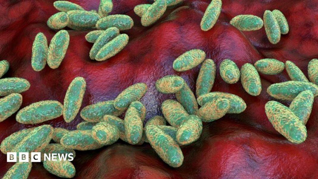 What is pneumonic plague and how does it spread? What is pneumonic plague and how does it spread?