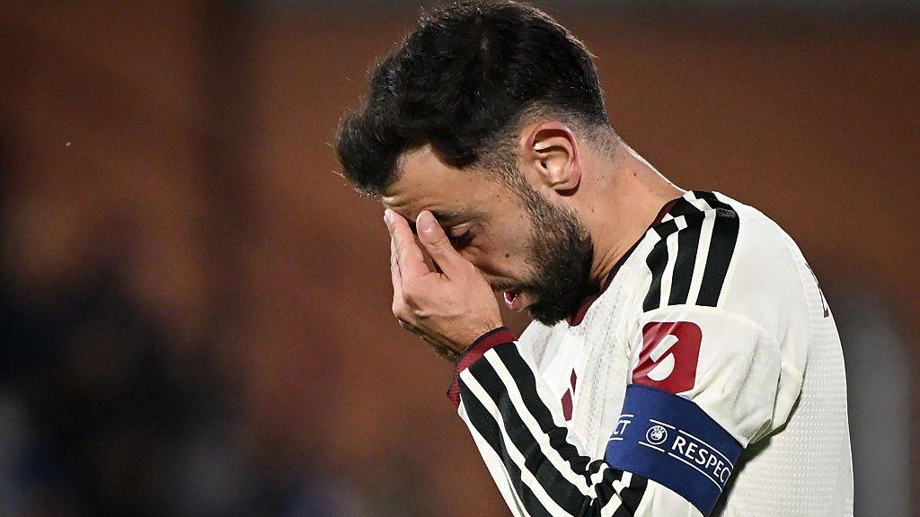 Manchester United captain Bruno Fernandes with his head in his hand