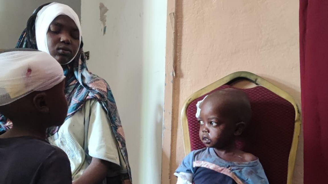 Three patients in a hospital. Two have bandaged heads, while a child sitting on a chair has a dressing on his head.