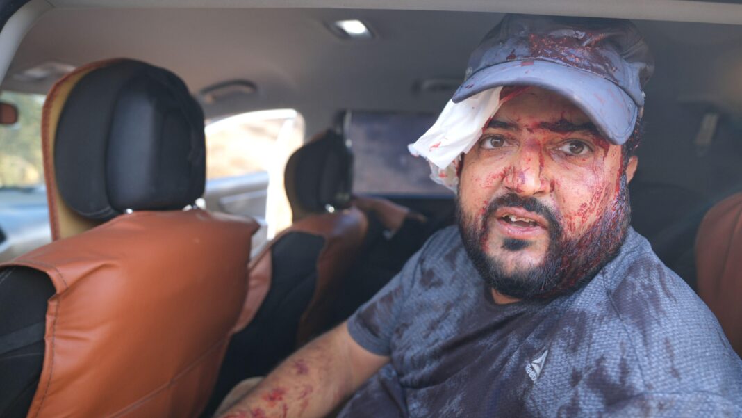 Palestinians and US journalist injured by Israeli settlers in West Bank harvest attack Yaser AlKam sits in the car with blood over his head and body