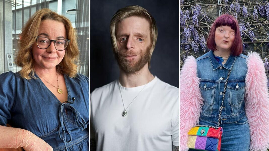 ‘Super offensive’ – We love how we look but AI tried to ‘fix’ our visible differences A composite image of three people with visible differences. Rhiannon has blonde wavy hair, wears glasses and is wearing a denim blue dress. Jono has blond hair and is wearing a white t-shirt. Kirsty has purple hair, and is wearing a denim jacket with pink fluffy sleeves.