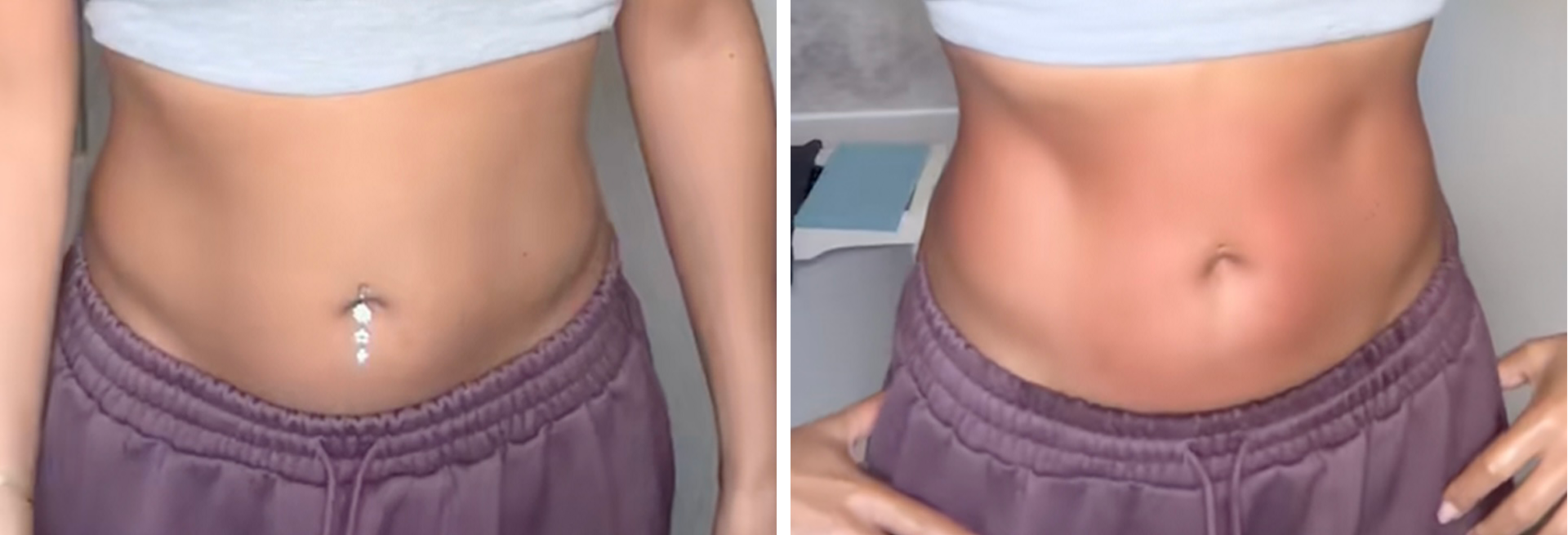 A before and after stomach lymphatic drainage massage image of a slim young woman with long dark curly hair wearing a grey sports bra and purple joggers. In the before photo on the left her tummy seems slightly rounded and she is wearing a belly button piercing. In the after photo on the right she does not have the piercing in, her tummy is slightly red and appears flatter with some abs  definition