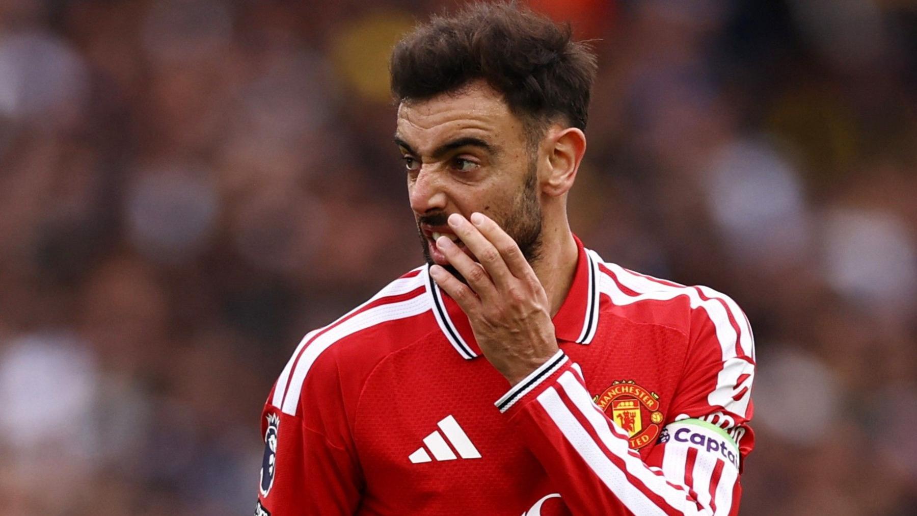 Bruno Fernandes scowls