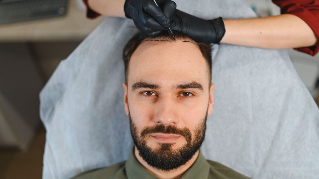 Top 10 Best Hair Transplant in Turkey image