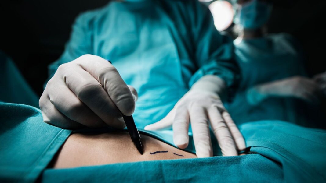‘Cosmetic cowboys’ to face fines if they carry out risky procedures Skynews surgery nhs 7381703